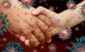 Qué es la Enfermedad X? La nueva alerta de la OMS por posible amenaza